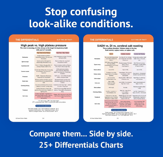 The Essential ICU Nursing Guide: Now What? -What To Do, What To Monitor, and What Not To Miss